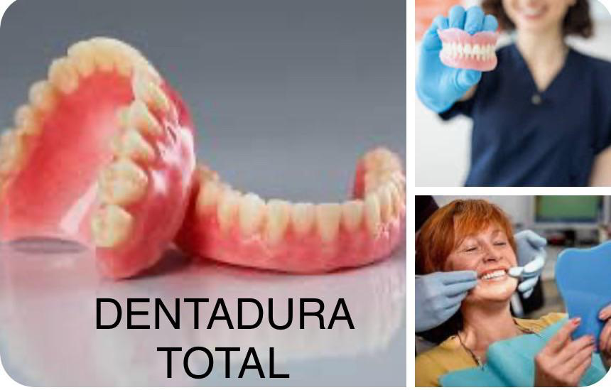 Servicio de dentadura total